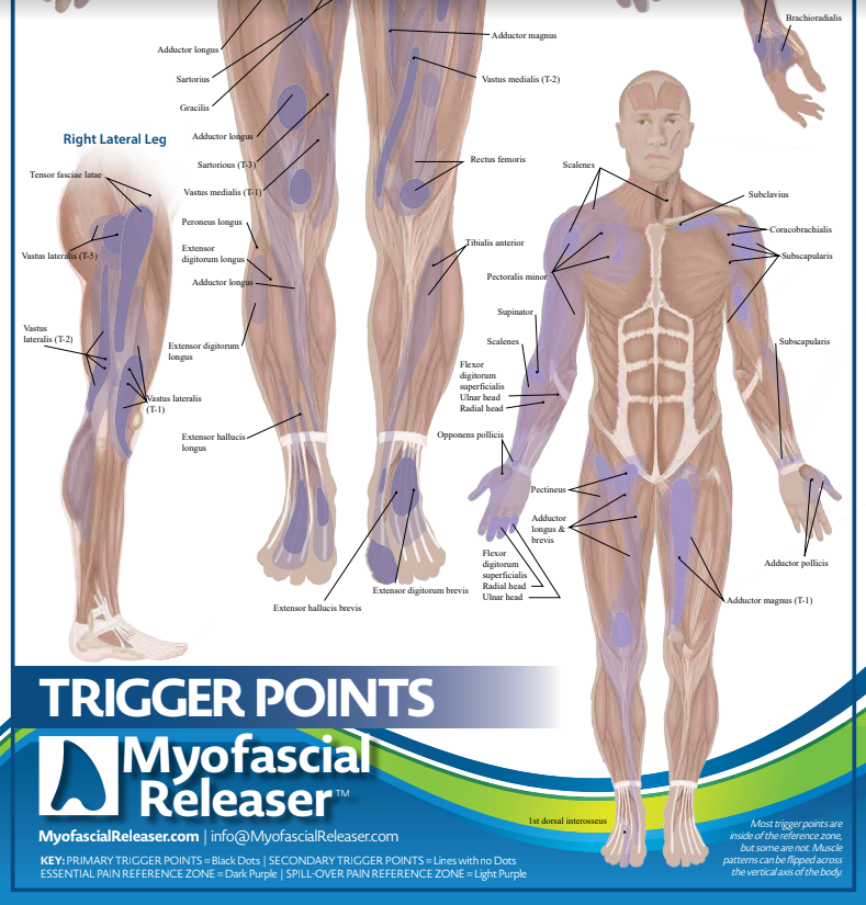 Two Trigger Point Anatomy Maps - Medical Office Wall Poster for Reference by Massage Therapists, Physical Therapists, Chiropractors, Trainers - Pressure Point and Referred Pain Chart (Poster sized) Pack of 2